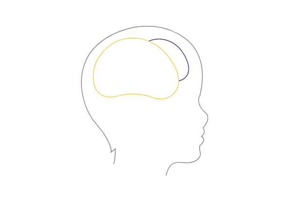 Little Stars and She Pediatric Neurology in Hyderabad