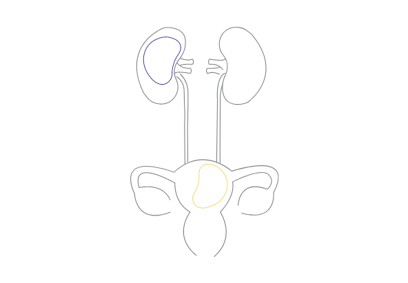 loading