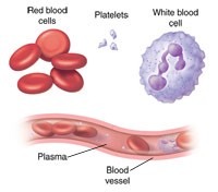 Anemia