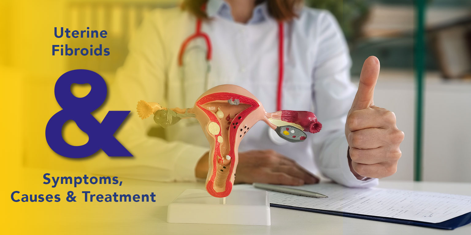 Uterine-Fibroids